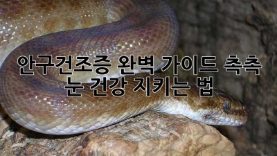 💻 안구건조증 완벽 가이드: 촉촉 눈 건강 지키는 법💧